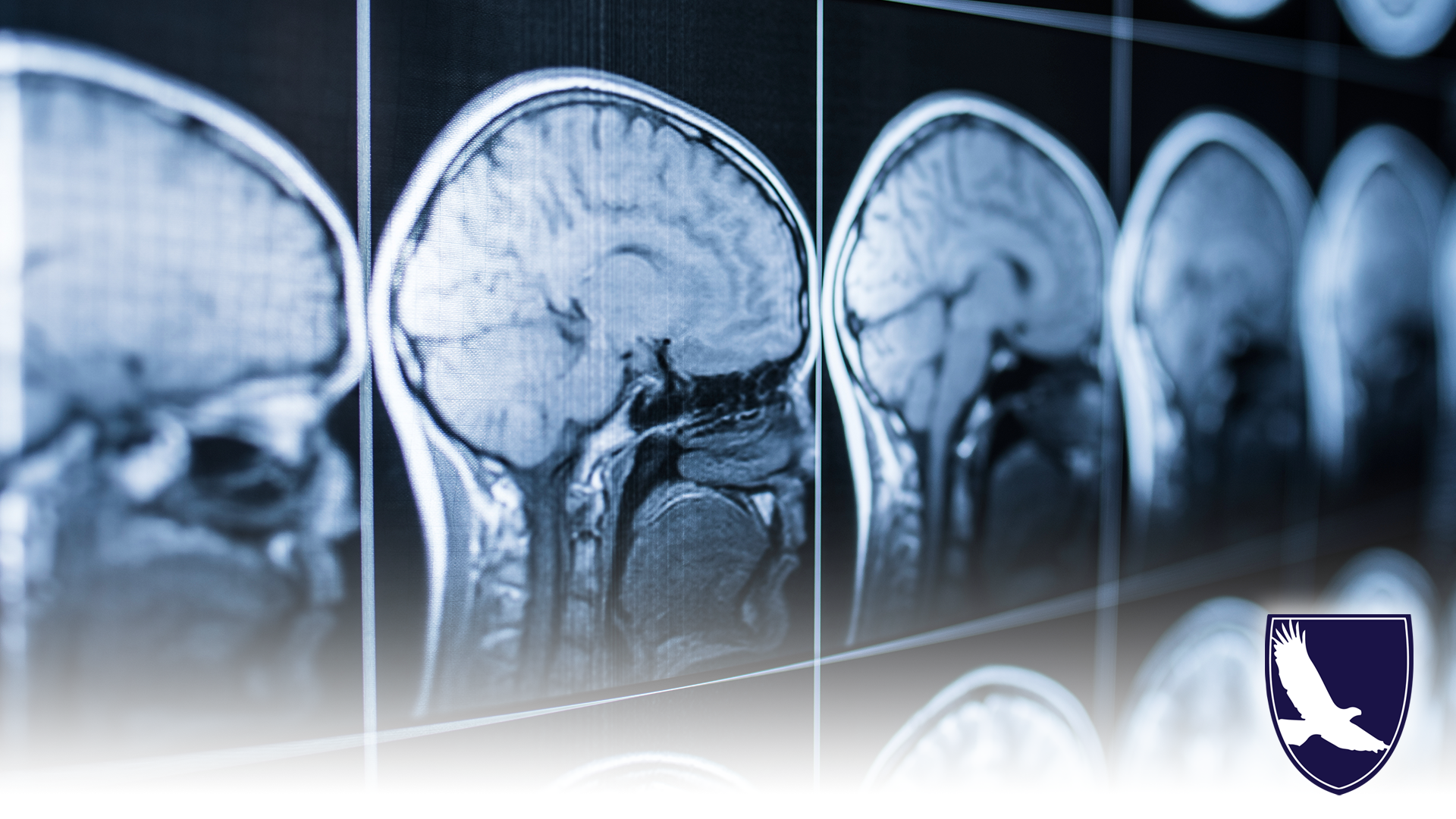 CAN I GET SOCIAL SECURITY DISABILITY SSDI SSI FOR A BRAIN INJURY